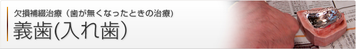 義歯（入れ歯）