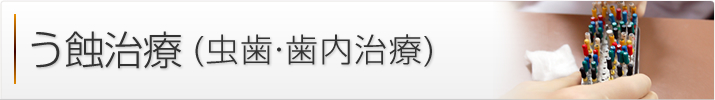う蝕治療(むし歯)・歯内治療 (歯根の治療)